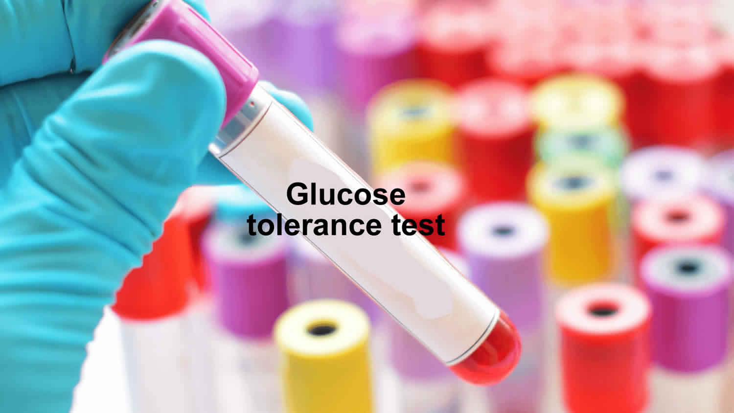 Glucose tolerance