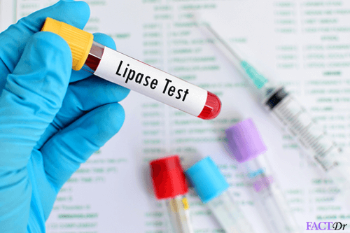 Lipase Blood Test