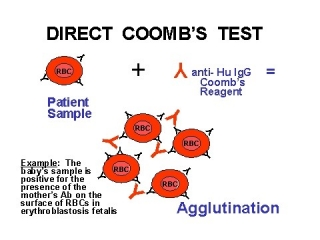 Coombs Test