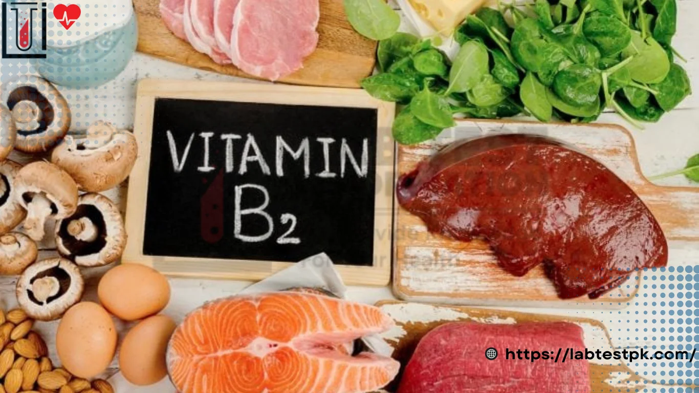 Vitamin B2 Test
