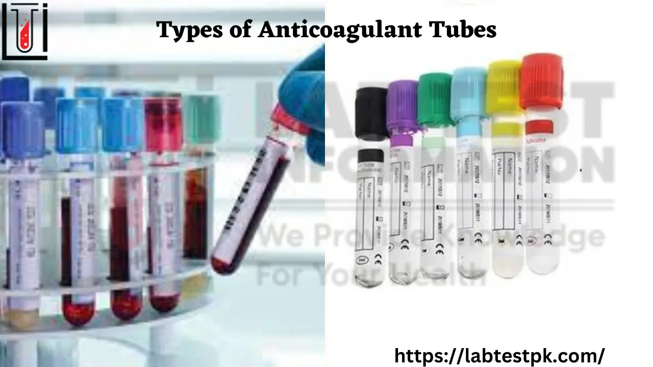 Types of Anticoagulant Tubes