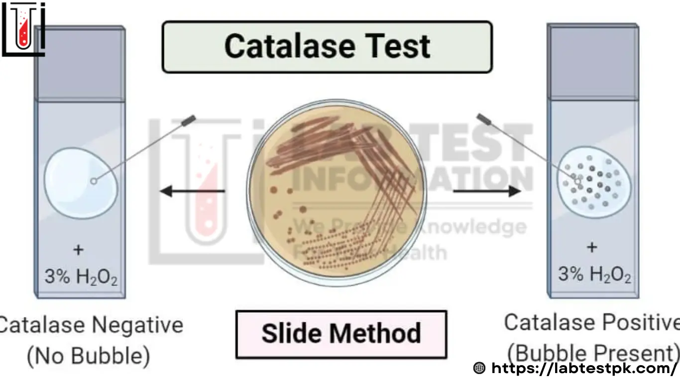 Catalase Test