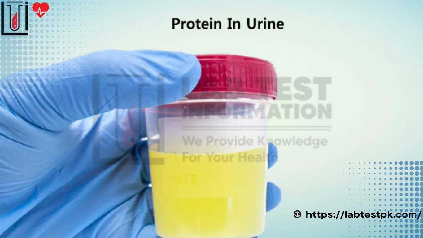 Urine Protein