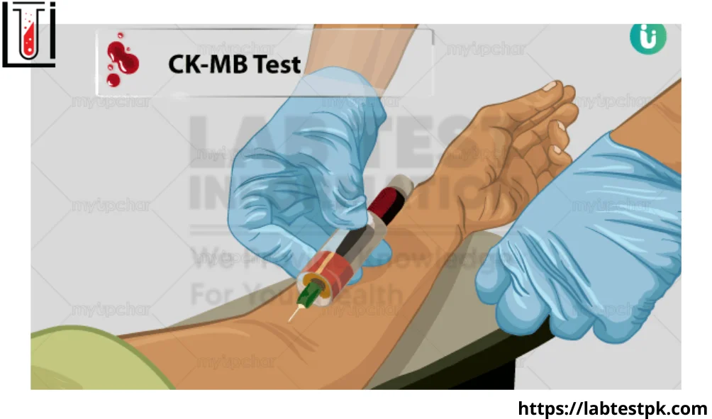 CK-MB Blood Test