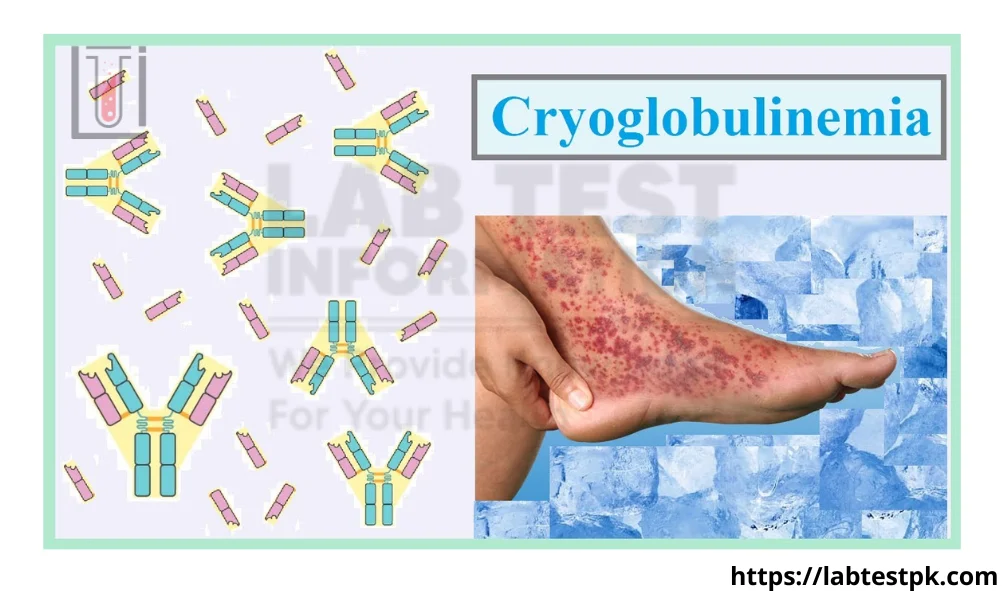Cryoglobulin Test