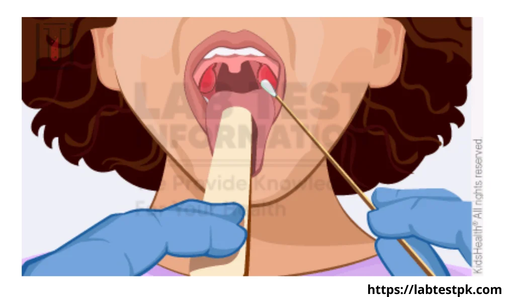 Throat Culture Test